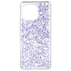 Funda Glitter Premium para Xiaomi Mi 11 - La Casa de las Carcasas
